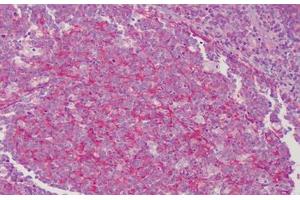 Human Tonsil: Formalin-Fixed, Paraffin-Embedded (FFPE) (TM7 Antikörper)