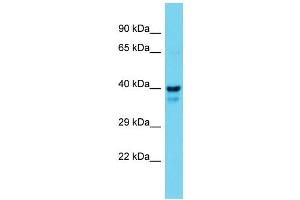 Western Blotting (WB) image for anti-Mitogen-Activated Protein Kinase Kinase 1 (MAP2K1) (N-Term) antibody (ABIN2788667) (MEK1 Antikörper  (N-Term))