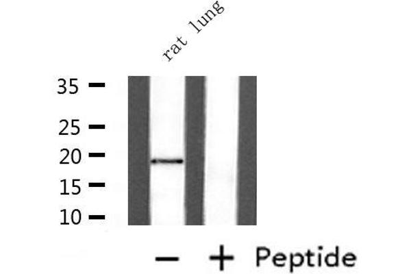 UBE2I Antikörper  (N-Term)