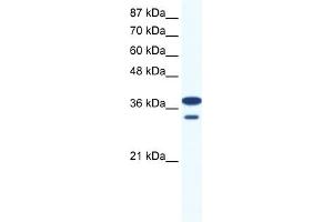 WB Suggested Anti-LHX3 Antibody Titration:  0. (LHX3 Antikörper  (Middle Region))