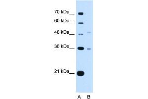 UST Antikörper  (C-Term)