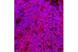 Immunofluorescence of paraffin embedded mouse splenitis using CCR2 (ABIN7073453) at dilution of 1:800 (400x lens) (CCR2 Antikörper)