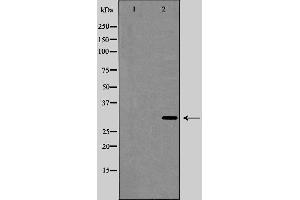 Western blot analysis of Interleukin 1β expression in HeLa cell lysate,The lane on the left is treated with the antigen-specific peptide. (IL-1 beta Antikörper  (Internal Region))