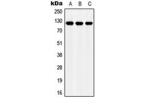 Western blot analysis of Apolipoprotein E Receptor 2 expression in MCF7 (A), NIH3T3 (B), H9C2 (C) whole cell lysates. (LRP8 Antikörper  (Center))