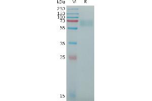 Alpha2 Antiplasmin (SERPINF2) (AA 28-491) protein (His tag)