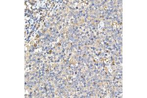 Immunohistochemistry of paraffin-embedded rat stomach using Phospho--S473 Rabbit mAb (ABIN6135179, ABIN6135970, ABIN6135971 and ABIN7101880) at dilution of 1:100 (40x lens). (AKT1 Antikörper  (pSer473))