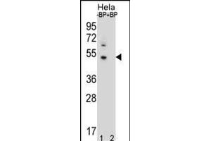 Western blot analysis of DNAJB6 Antibody (Center) Pab (ABIN656424 and ABIN2845716) pre-incubated without(lane 1) and with(lane 2) blocking peptide in Hela cell line lysate. (DNAJB6 Antikörper  (AA 218-247))