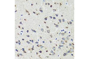 Immunohistochemistry of paraffin-embedded mouse brain using CCDC124 antibody  at dilution of 1:100 (40x lens). (CCDC124 Antikörper  (AA 1-223))