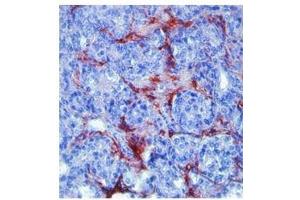 Immunohistochemistry (IHC) image for anti-Matrix Metallopeptidase 9 (Gelatinase B, 92kDa Gelatinase, 92kDa Type IV Collagenase) (MMP9) antibody (ABIN630147)