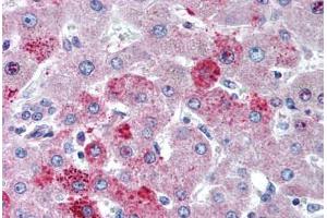 Human Liver (formalin-fixed, paraffin-embedded) stained with CCR10 antibody ABIN291274 at 5 ug/ml followed by biotinylated goat anti-rabbit IgG secondary antibody ABIN481713, alkaline phosphatase-streptavidin and chromogen. (CCR10 Antikörper  (AA 350-362))