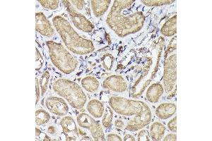 Immunohistochemistry of paraffin-embedded mouse kidney using METTL4 Rabbit pAb (ABIN6133091, ABIN6143773, ABIN6143774 and ABIN6224964) at dilution of 1:100 (40x lens). (METTL4 Antikörper  (AA 1-190))