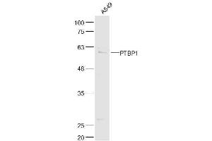A549 lysates probed with PTBP1 Polyclonal Antibody, Unconjugated  at 1:500 dilution and 4˚C overnight incubation. (PTBP1 Antikörper  (AA 451-531))