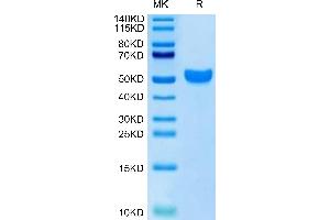 Human NKG2C on Tris-Bis PAGE under reduced condition. (KLRC2 Protein (AA 98-231) (Fc Tag))