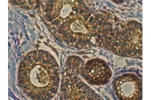 Immunohistochemistry (IHC) image for anti-RAB11A, Member RAS Oncogene Family (RAB11A) (C-Term) antibody (ABIN1440025) (RAB11A Antikörper  (C-Term))