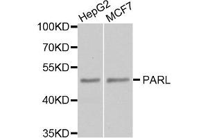 Western blot analysis of extract of HepG2 and MCF7 cells, using PARL antibody. (PARL Antikörper)