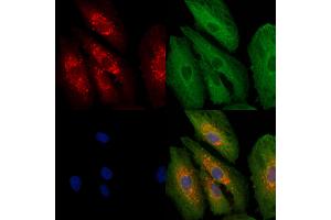 ABIN6262019 and ABIN6279471 staining  cells by IF/ICC. (GNG3 Antikörper  (N-Term))