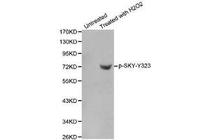 Western blot analysis of extracts from Jurkat cells using phospho-SYK-Y323 antibody. (SYK Antikörper  (pTyr323))