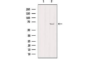 Western blot analysis of extracts from HepG2, using SLC27A2 Antibody.