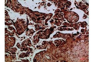 Immunohistochemical analysis of paraffin-embedded Human-placenta, antibody was diluted at 1:100 (NAIP Antikörper  (AA 1191-1240))