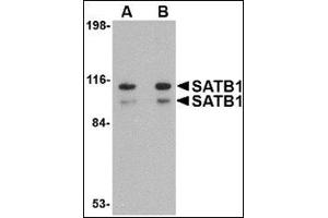 Western blot analysis of SATB1 in SK-N-SH cell lysate with this product at (A) 1 and (B) 2 μg/ml. (SATB1 Antikörper  (N-Term))