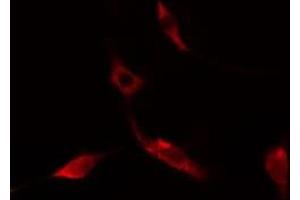 ABIN6275521 staining NIH-3T3 cells by IF/ICC. (Septin 14 Antikörper  (C-Term))
