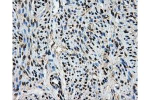 Immunohistochemical staining of paraffin-embedded Kidney tissue using anti-BRAFmouse monoclonal antibody. (BRAF Antikörper)