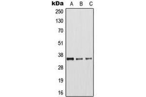 Western blot analysis of Arginase 1 expression in MCF7 (A), mouse liver (B), rat kidney (C) whole cell lysates. (Liver Arginase Antikörper  (Center))