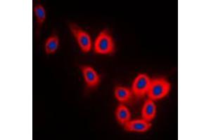 Immunofluorescent analysis of TAU staining in SKNSH cells. (tau Antikörper  (C-Term))