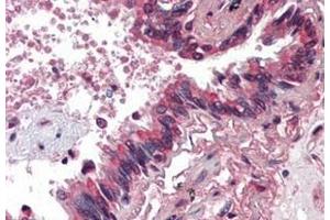 Immunohistochemistry (Paraffin-embedded Sections) (IHC (p)) image for anti-Bone Morphogenetic Protein 4 (BMP4) antibody (ABIN615043)