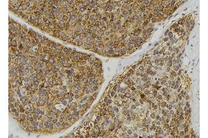 ABIN6269391 at 1/100 staining Human pancreas tissue by IHC-P. (ASK1 Antikörper  (N-Term))