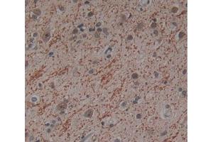 Used in DAB staining on fromalin fixed paraffin- embedded Kidney tissue (ICK Antikörper  (AA 1-284))