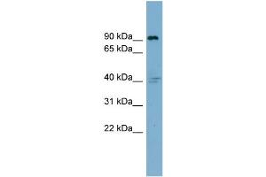 WB Suggested Anti-ITGB5 Antibody Titration:  0. (Integrin beta 5 Antikörper  (Middle Region))