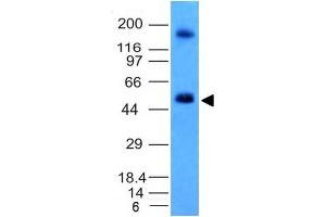 Western Blot Analysis of HCT116 cell lysate CAIX Mouse Monoclonal Antibody (CA9/781). (CA9 Antikörper)