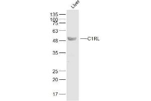 Mouse liver lysates probed with C1RL Polyclonal Antibody, Unconjugated  at 1:500 dilution and 4˚C overnight incubation. (C1RL Antikörper  (AA 101-200))