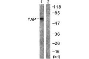 Western blot analysis of extracts from HepG2 cells, treated with Wortmannin 40nM 24h, using YAP (Ab-127) Antibody. (YAP1 Antikörper  (AA 93-142))
