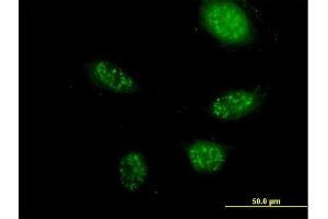Immunofluorescence of purified MaxPab antibody to ZNF501 on HeLa cell. (ZNF501 Antikörper  (AA 1-262))