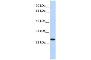 NKAIN4 antibody used at 1 ug/ml to detect target protein. (NKAIN4 Antikörper  (N-Term))