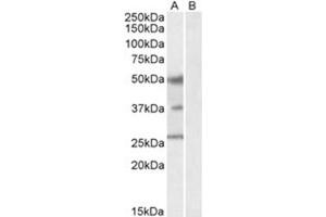 Image no. 1 for anti-Forkhead Box A1 (FOXA1) (C-Term) antibody (ABIN374334) (FOXA1 Antikörper  (C-Term))