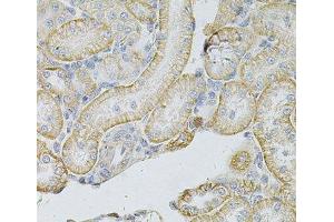 Immunohistochemistry of paraffin-embedded Rat kidney using MSLN Polyclonal Antibody at dilution of 1:100 (40x lens). (Mesothelin Antikörper)