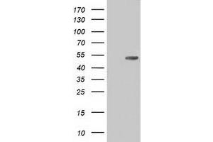 HEK293T cells were transfected with the pCMV6-ENTRY control (Left lane) or pCMV6-ENTRY CD5 (Right lane) cDNA for 48 hrs and lysed. (CD5 Antikörper)