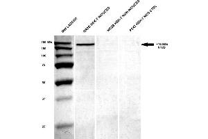 Western Blot analysis of Human HEK-T lysates showing detection of GluN2B/NR2B protein using Mouse Anti-GluN2B/NR2B Monoclonal Antibody, Clone S59-36 . (GRIN2B Antikörper  (AA 20-271) (Atto 390))