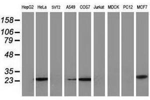 Image no. 4 for anti-Adenylate Kinase 4 (AK4) antibody (ABIN1496530) (AK4 Antikörper)