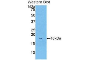 Western Blotting (WB) image for anti-Lecithin-Cholesterol Acyltransferase (LCAT) (AA 290-433) antibody (Biotin) (ABIN1176764) (LCAT Antikörper  (AA 290-433) (Biotin))
