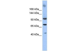 WB Suggested Anti-TUT1 Antibody Titration: 0. (TUT1 Antikörper  (N-Term))