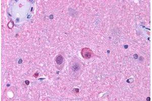 Anti-NPY5R antibody  ABIN1049127 IHC staining of human brain, neurons and glia. (NPY5R Antikörper  (Cytoplasmic Domain))