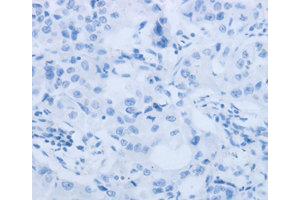 Immunohistochemistry (IHC) image for anti-Matrix Metallopeptidase 25 (MMP25) antibody (ABIN1873725) (MMP25 Antikörper)