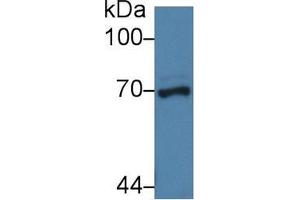 Western blot analysis of Pig Liver lysate, using Human NUP62 Antibody (3 µg/ml) and HRP-conjugated Goat Anti-Rabbit antibody ( (NUP62 Antikörper  (AA 186-432))