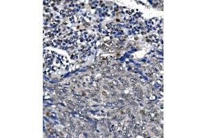 IHC analysis of POLR2A using anti-POLR2A antibody (ABIN7599598).