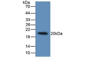 Western blot analysis of recombinant Human IL19. (IL-19 Antikörper  (AA 25-177))