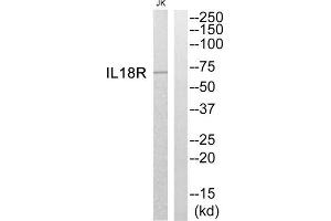 Western blot analysis of extracts from Jurkat cells, using IL18R antibody. (IL1RAPL2 Antikörper  (Internal Region))